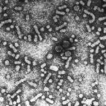 Electronic photography of HBV viral particles (photography reproduced with permission from CDC, Centers for Disease Control).