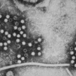 Hepatitis E virus micrograph