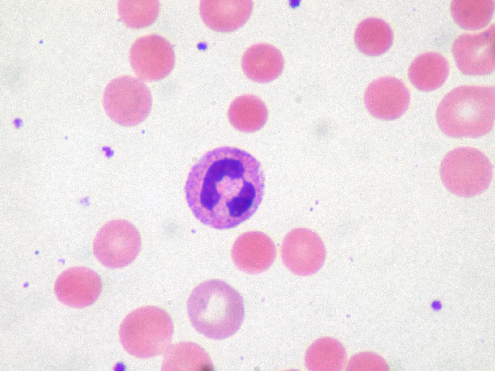 Red blood cells on a blood smear