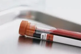 Blood draw for the coagulation workup
