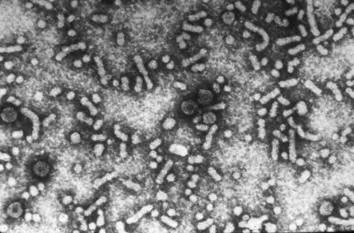 Hepatitis B virus particles seen under the electron microscope